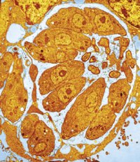 common-parasite-linked-to-personali_1