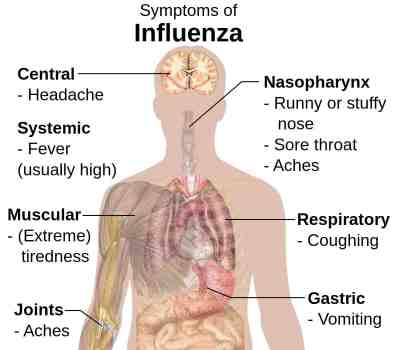 1200px-Symptoms_of_influenza